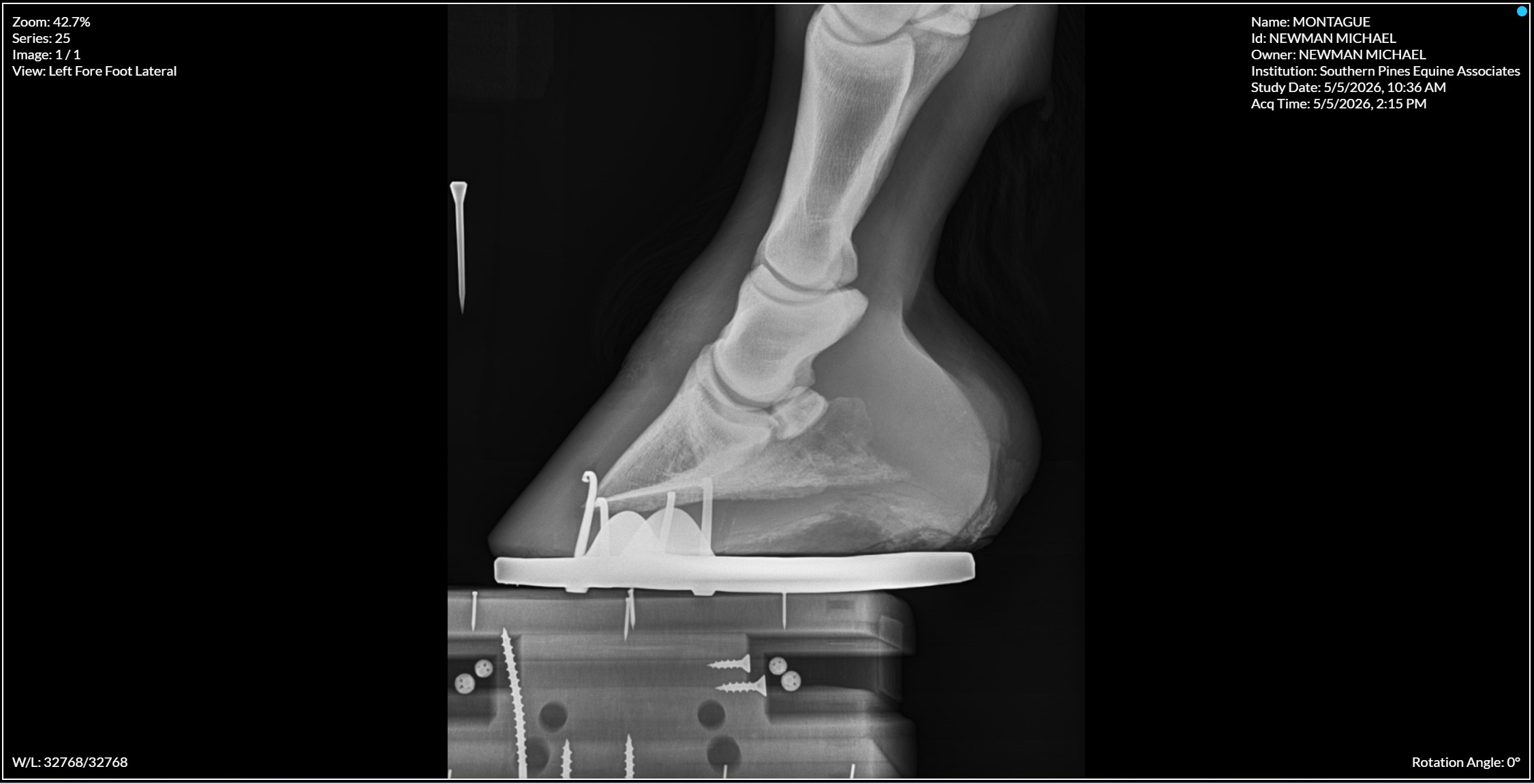 Left Forefoot Lateral